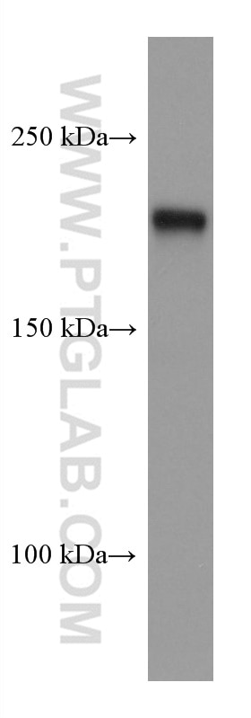 Western Blot (WB) analysis of rat brain tissue using PHLPP Monoclonal antibody (67640-1-Ig)