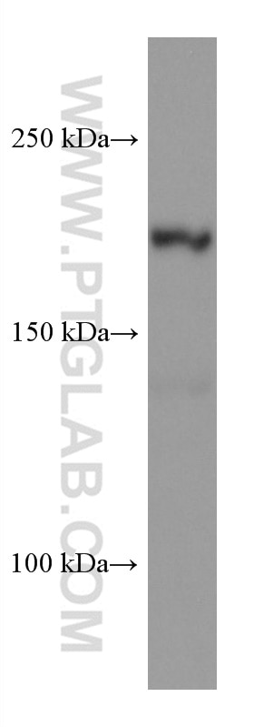 Western Blot (WB) analysis of pig brain tissue using PHLPP Monoclonal antibody (67640-1-Ig)