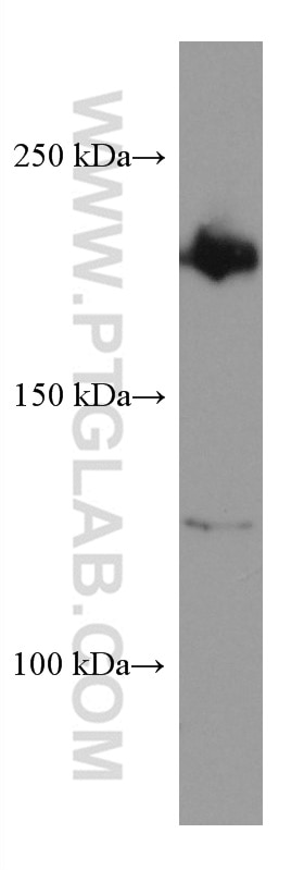 Western Blot (WB) analysis of HEK-293 cells using PHLPP Monoclonal antibody (67640-1-Ig)