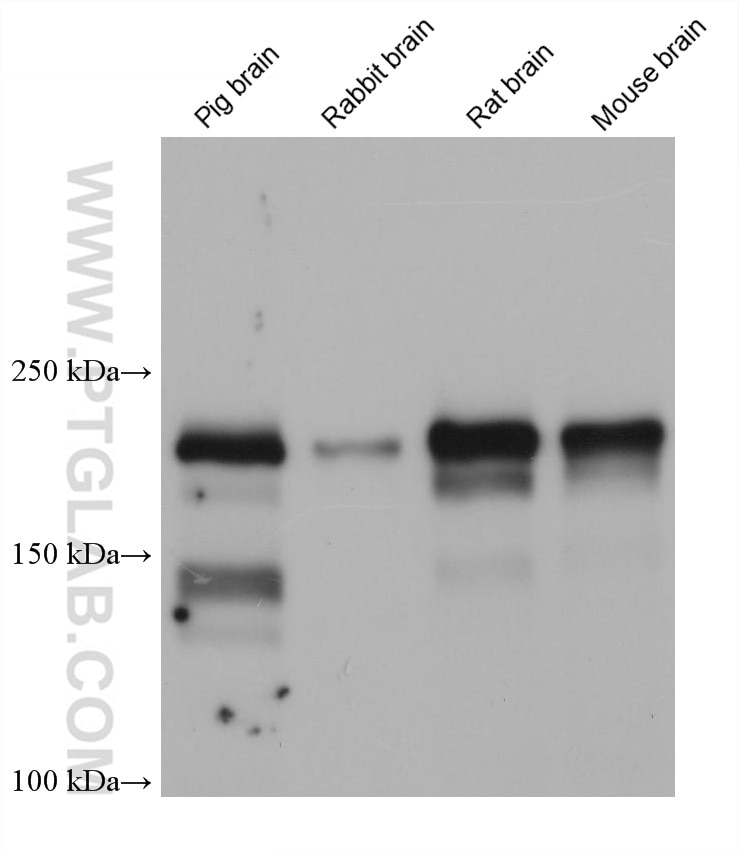 Various lysates were subjected to SDS PAGE followed by western blot with 67640-1-Ig (PHLPP antibody) at dilution of 1:5000 incubated at room temperature for 1.5 hours. Western Blot (WB) analysis of various lysates using PHLPP1 Monoclonal antibody (67640-1-Ig)