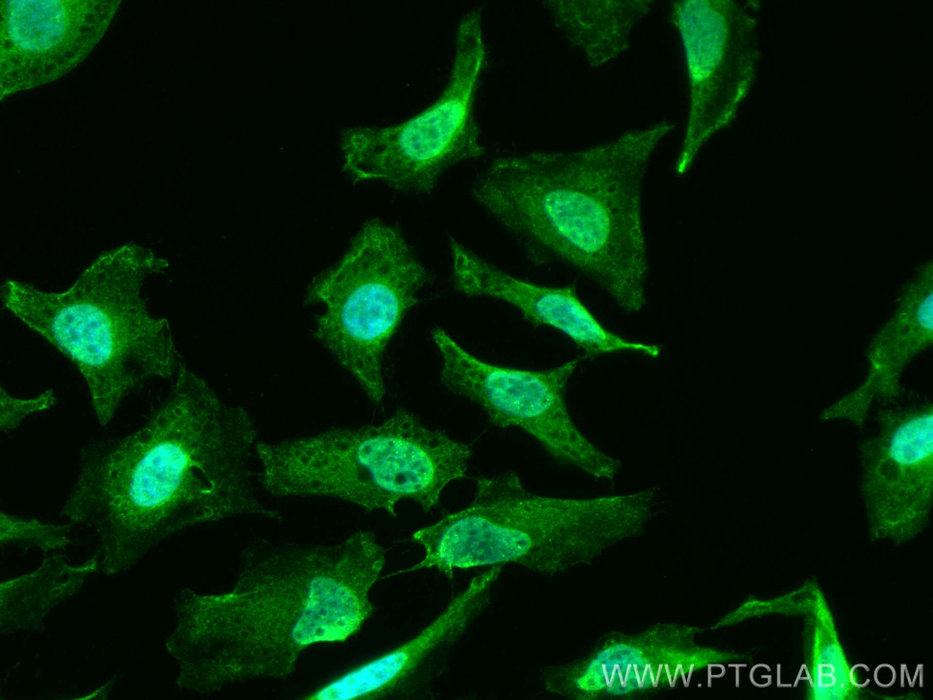 IF Staining of HeLa using CL488-22789