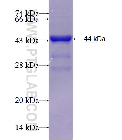 PHLPP fusion protein Ag18794 SDS-PAGE