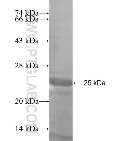 PHLPP fusion protein Ag18982 SDS-PAGE