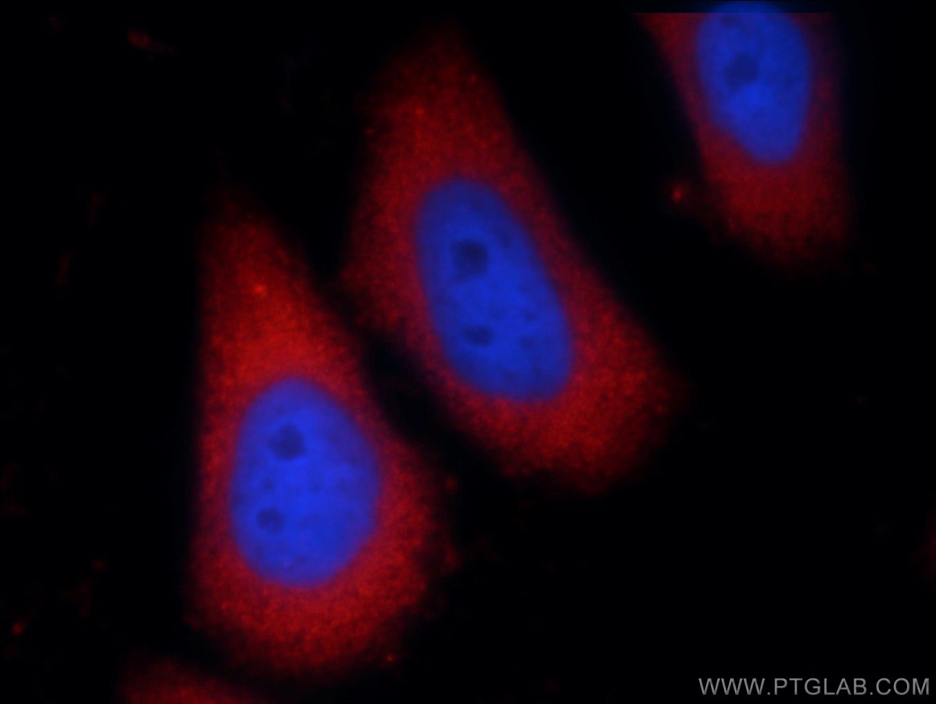 Immunofluorescence (IF) / fluorescent staining of HeLa cells using PHLPPL Polyclonal antibody (25244-1-AP)