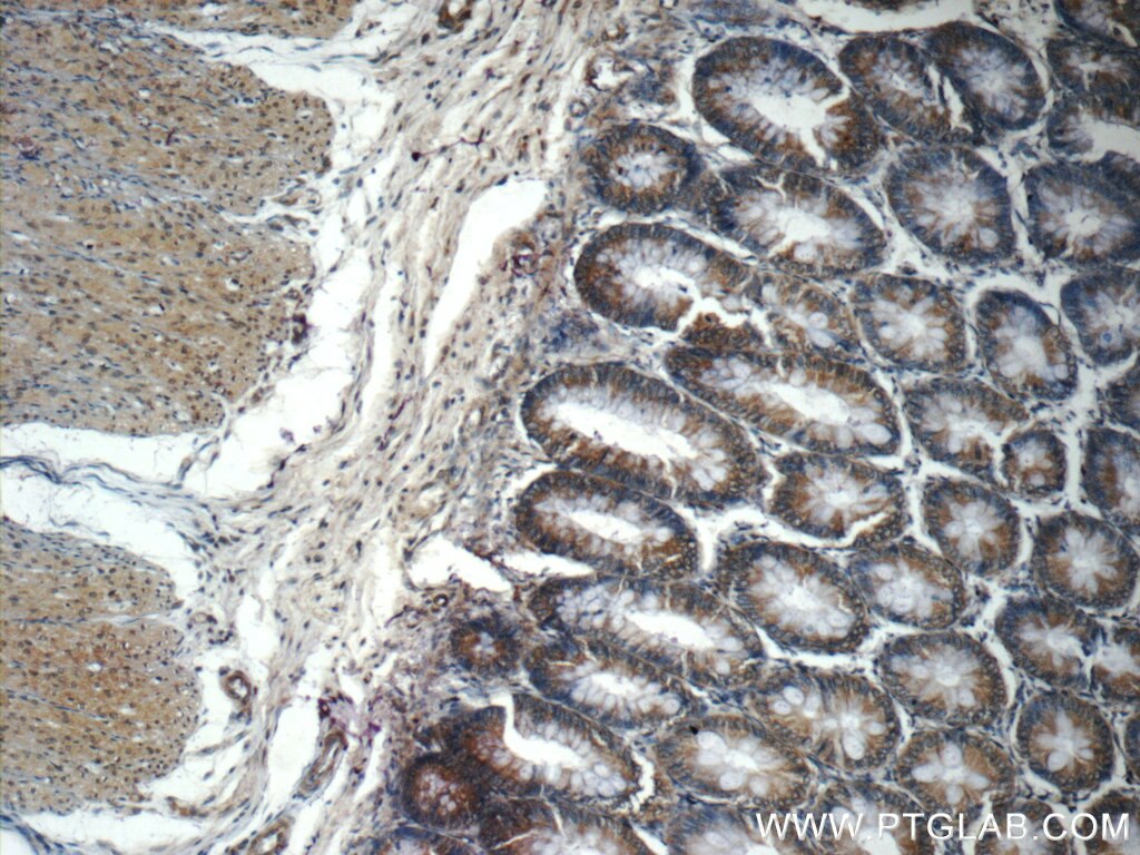 Immunohistochemistry (IHC) staining of human colon tissue using PHLPPL Polyclonal antibody (25244-1-AP)