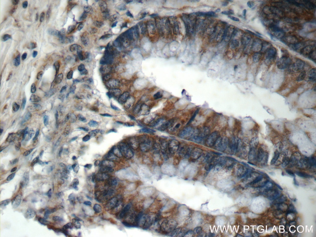 Immunohistochemistry (IHC) staining of human colon tissue using PHLPPL Polyclonal antibody (25244-1-AP)