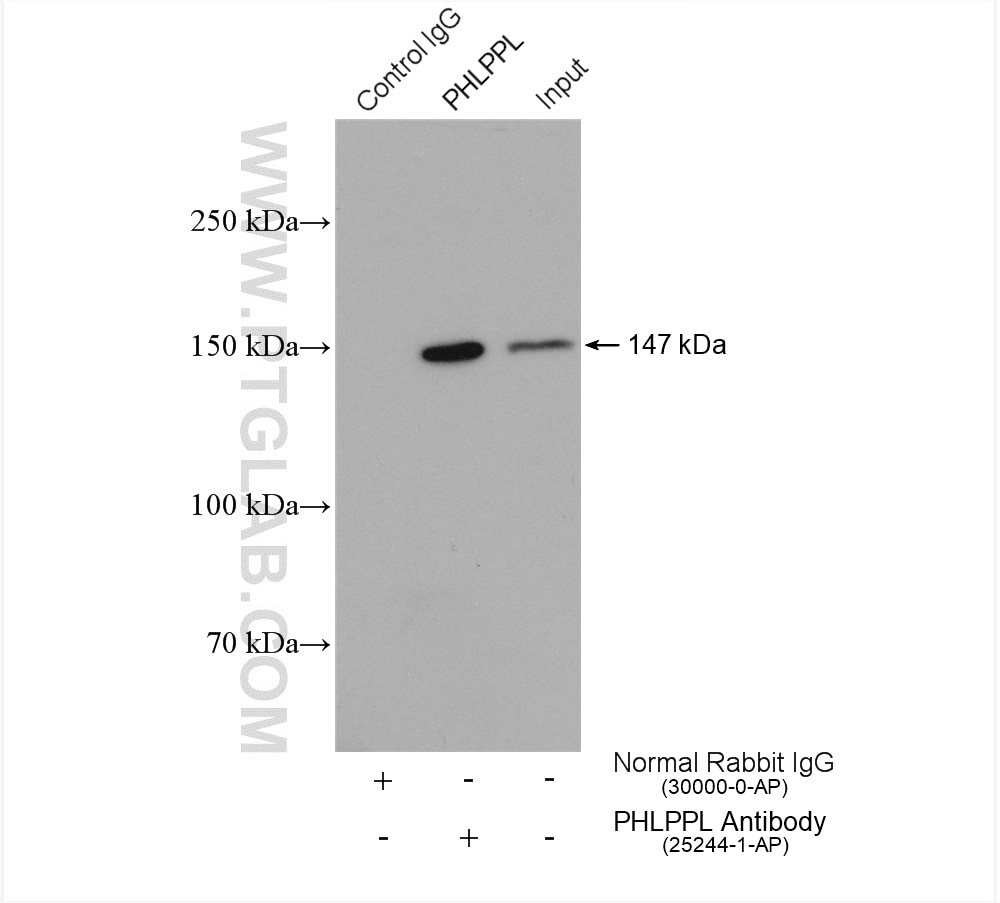 Immunoprecipitation (IP) experiment of HeLa cells using PHLPPL Polyclonal antibody (25244-1-AP)