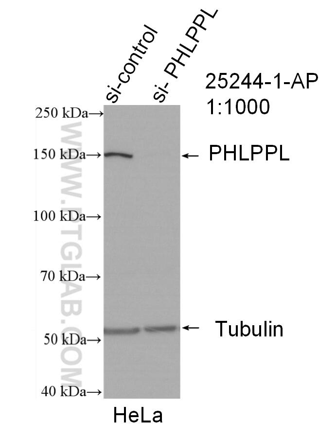 Western Blot (WB) analysis of HeLa cells using PHLPPL Polyclonal antibody (25244-1-AP)