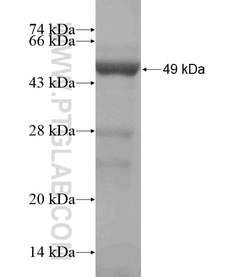 PHLPPL fusion protein Ag19198 SDS-PAGE