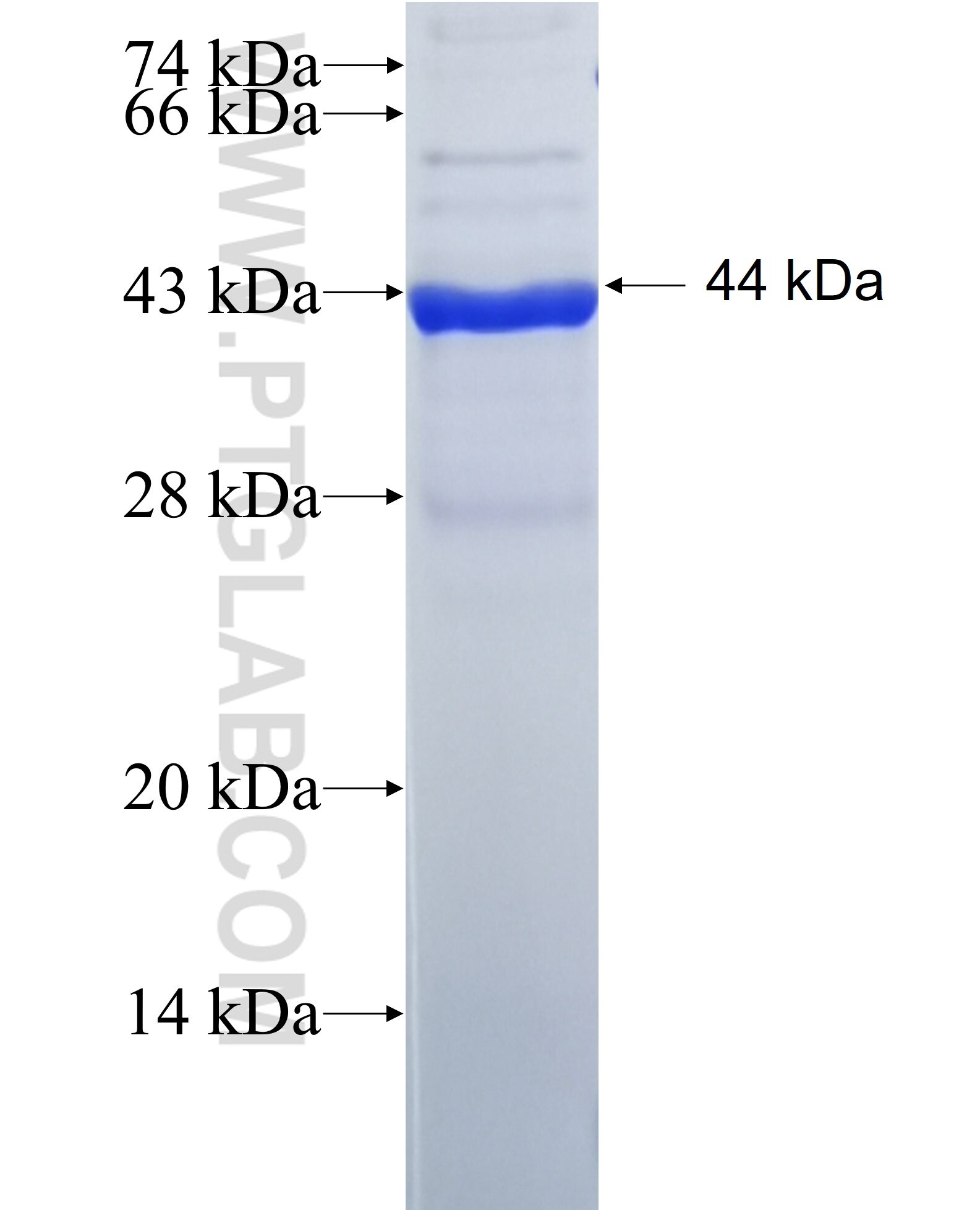 PHOSPHO1 fusion protein Ag26949 SDS-PAGE