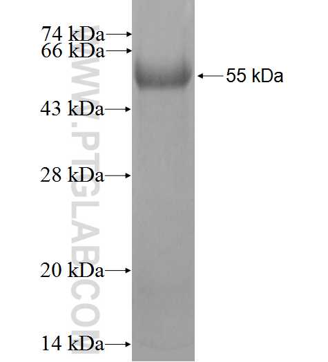 PHOSPHO2 fusion protein Ag2451 SDS-PAGE