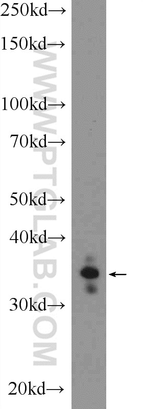 Western Blot (WB) analysis of SH-SY5Y cells using PHOX2A Polyclonal antibody (25804-1-AP)