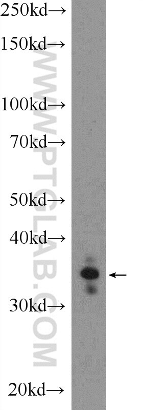 WB analysis of SH-SY5Y using 25804-1-AP