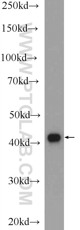 Western Blot (WB) analysis of HeLa cells using PHOX2A Polyclonal antibody (25804-1-AP)
