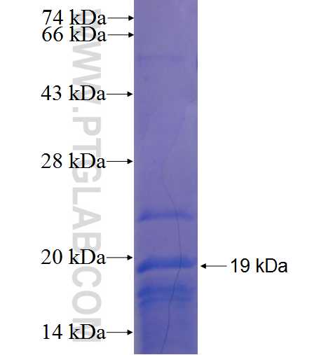 PHOX2A fusion protein Ag22873 SDS-PAGE