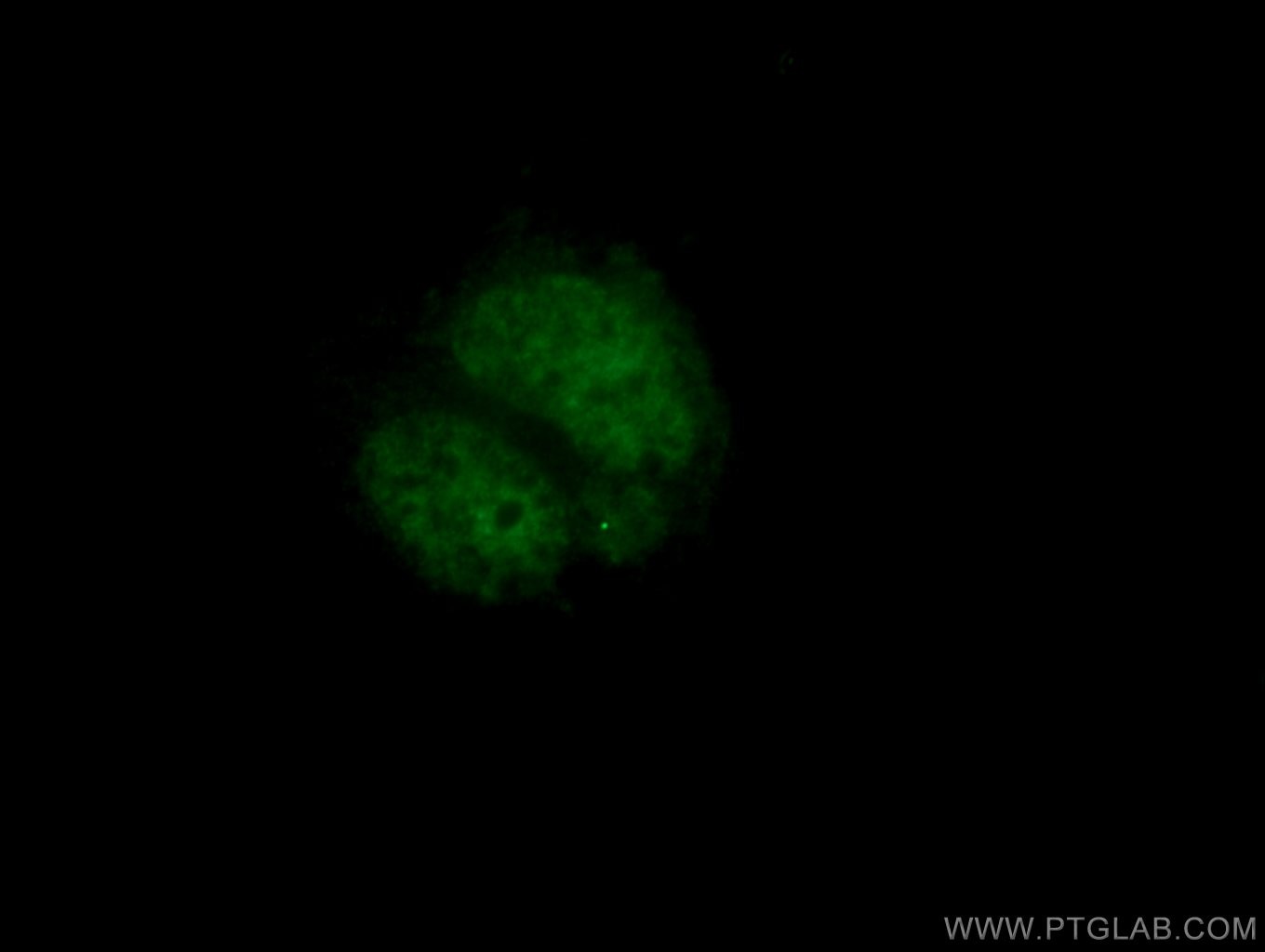 Immunofluorescence (IF) / fluorescent staining of Neuro-2a cells using PHOX2B Polyclonal antibody (25276-1-AP)