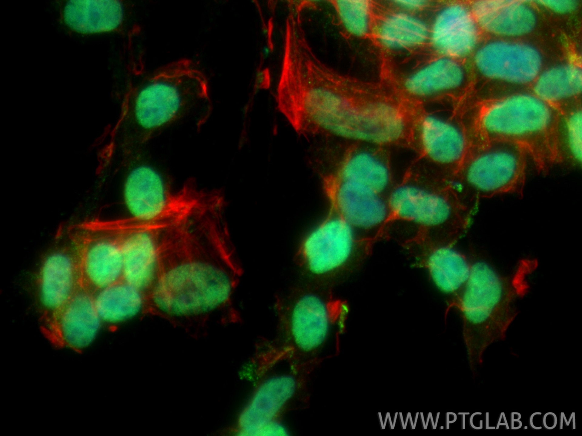 Immunofluorescence (IF) / fluorescent staining of SH-SY5Y cells using PHOX2B Polyclonal antibody (25276-1-AP)