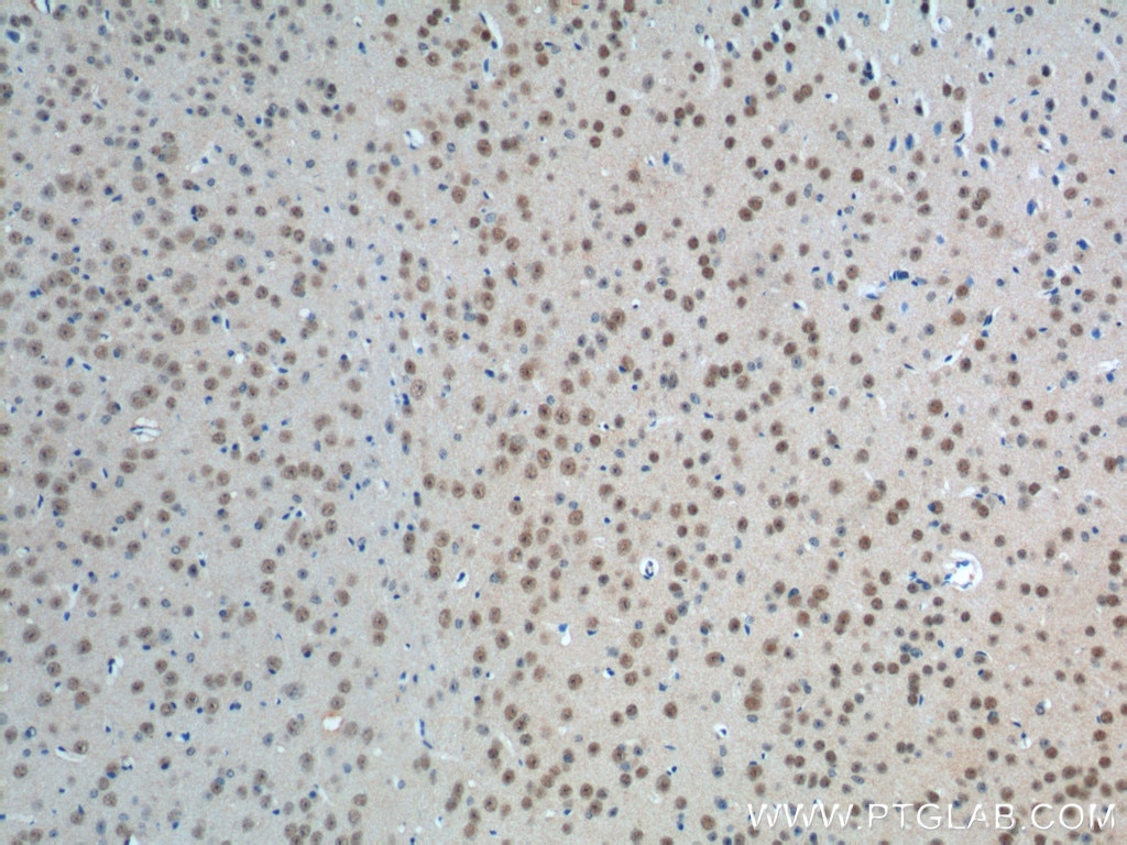 Immunohistochemistry (IHC) staining of mouse brain tissue using PHOX2B Polyclonal antibody (25276-1-AP)