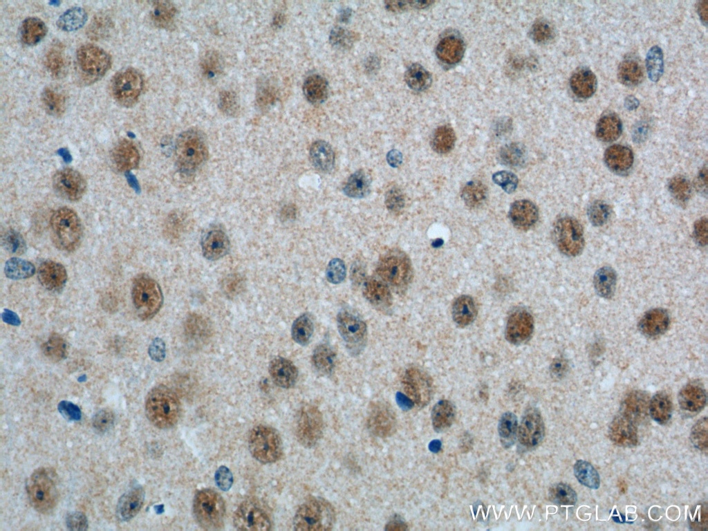 Immunohistochemistry (IHC) staining of mouse brain tissue using PHOX2B Polyclonal antibody (25276-1-AP)