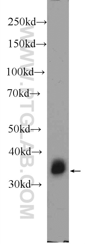 Western Blot (WB) analysis of Neuro-2a cells using PHOX2B Polyclonal antibody (25276-1-AP)