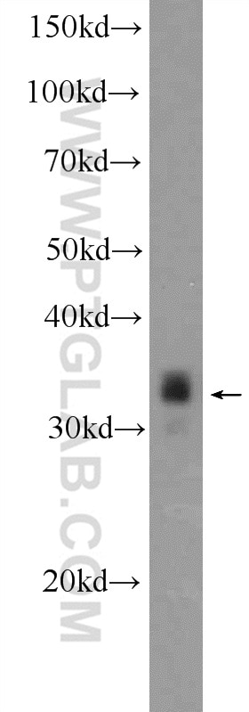 Western Blot (WB) analysis of Neuro-2a cells using PHOX2B Polyclonal antibody (25276-1-AP)