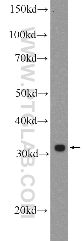 Western Blot (WB) analysis of SH-SY5Y cells using PHOX2B Polyclonal antibody (25276-1-AP)