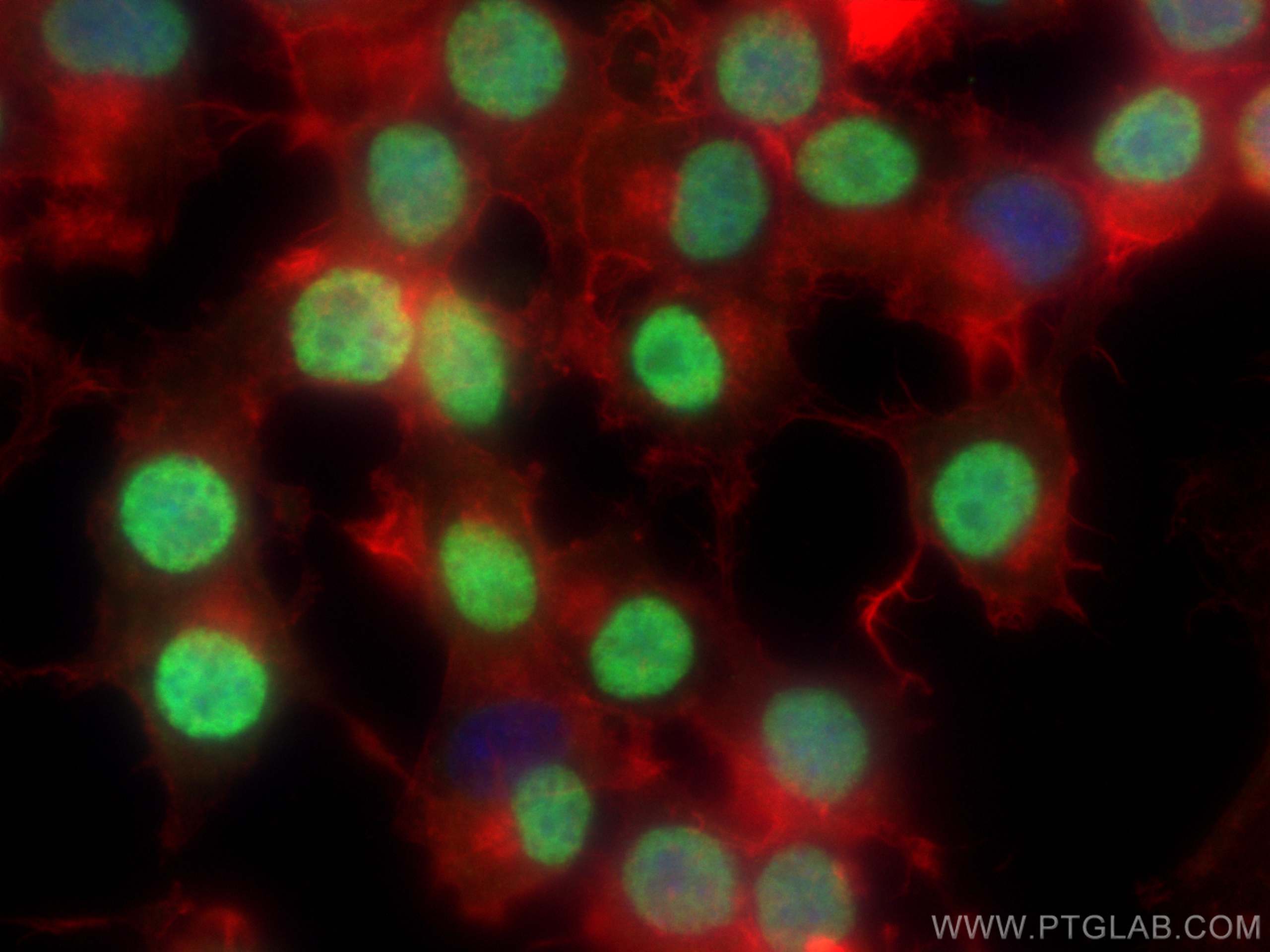 Immunofluorescence (IF) / fluorescent staining of Neuro-2a cells using PHOX2B Monoclonal antibody (66254-1-Ig)