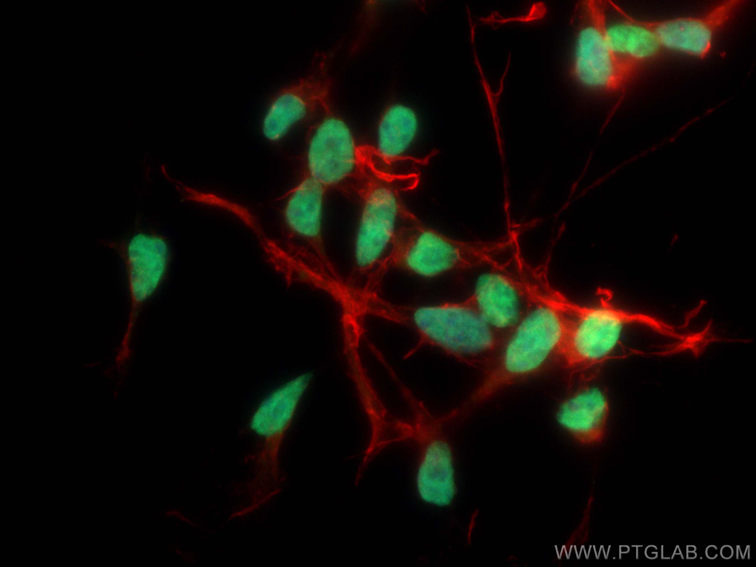 IF Staining of SH-SY5Y using 66254-1-Ig