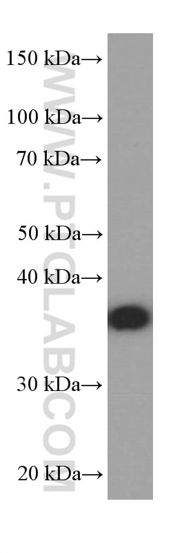 Western Blot (WB) analysis of Neuro-2a cells using PHOX2B Monoclonal antibody (66254-1-Ig)
