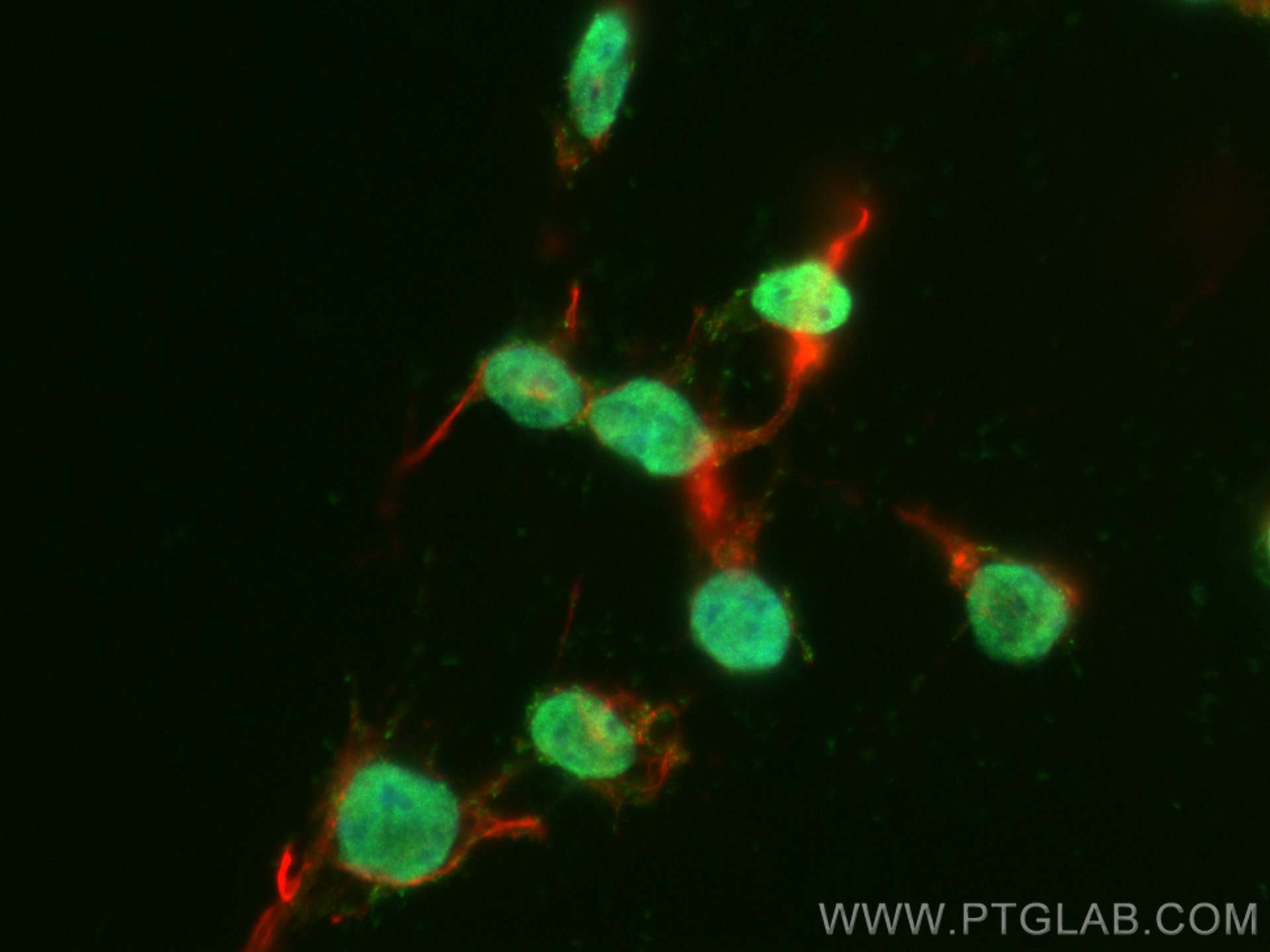 IF Staining of SH-SY5Y using CL488-25276