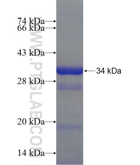 PHOX2B fusion protein Ag13196 SDS-PAGE