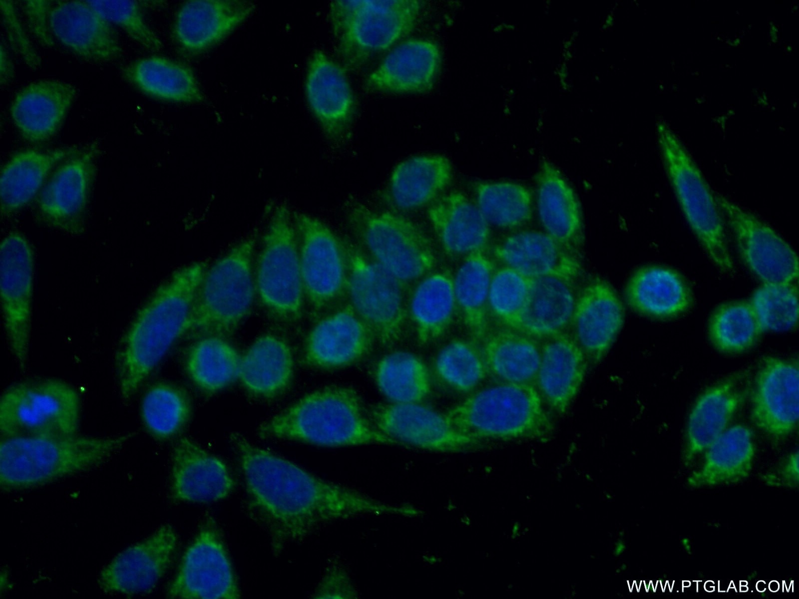 IF Staining of HeLa using 13112-1-AP