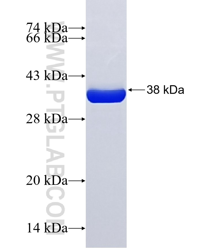 PHPT1 fusion protein Ag3778 SDS-PAGE