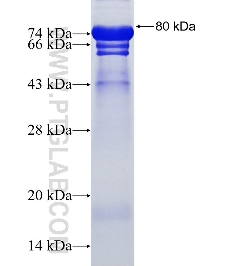 PHRF1 fusion protein Ag20048 SDS-PAGE