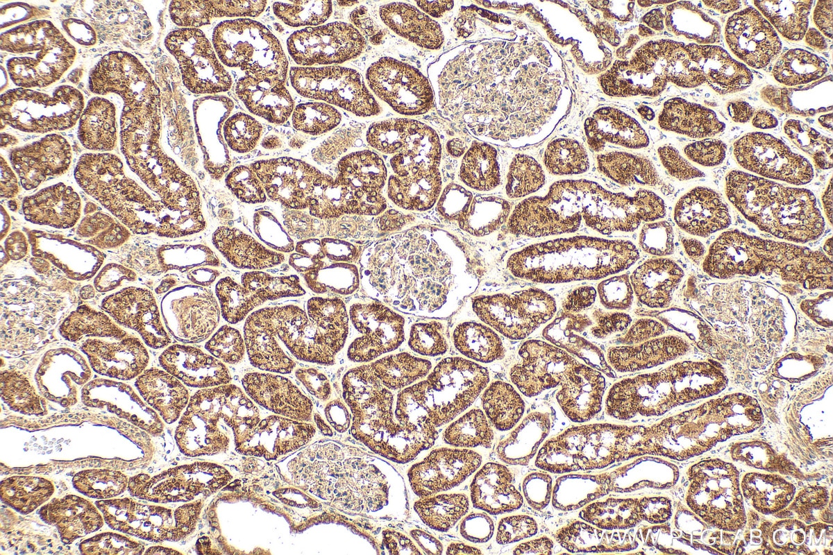 Immunohistochemistry (IHC) staining of human kidney tissue using PHYH Polyclonal antibody (12858-1-AP)