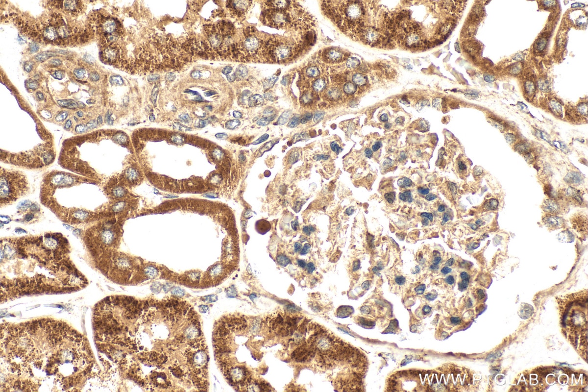 Immunohistochemistry (IHC) staining of human kidney tissue using PHYH Polyclonal antibody (12858-1-AP)