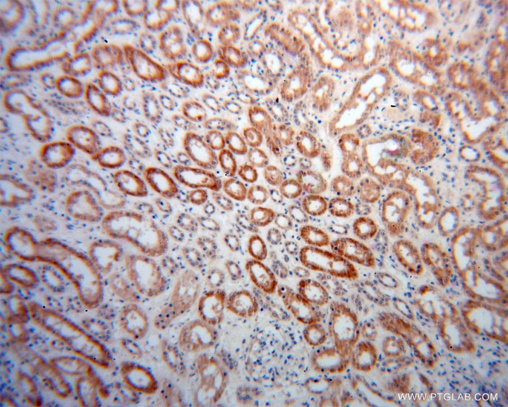 Immunohistochemistry (IHC) staining of human kidney tissue using PHYH Polyclonal antibody (12858-1-AP)