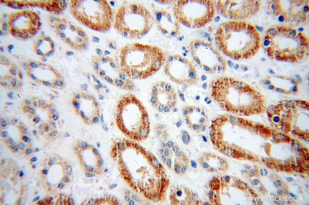 Immunohistochemistry (IHC) staining of human kidney tissue using PHYH Polyclonal antibody (12858-1-AP)