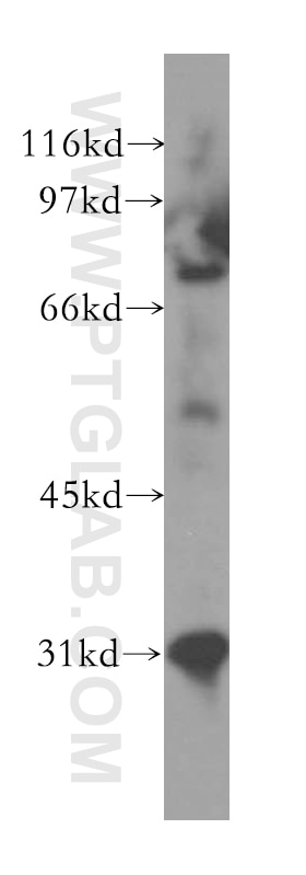 Western Blot (WB) analysis of human kidney tissue using PHYH Polyclonal antibody (12858-1-AP)
