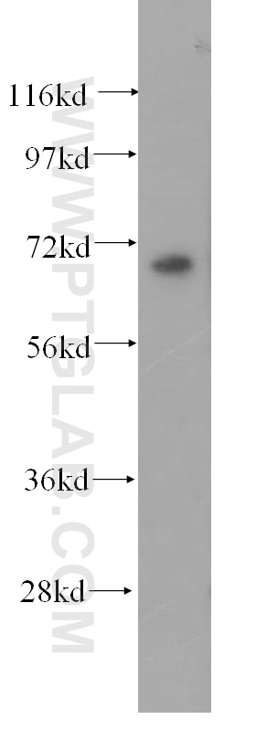Western Blot (WB) analysis of Jurkat cells using PHYH Polyclonal antibody (12858-1-AP)