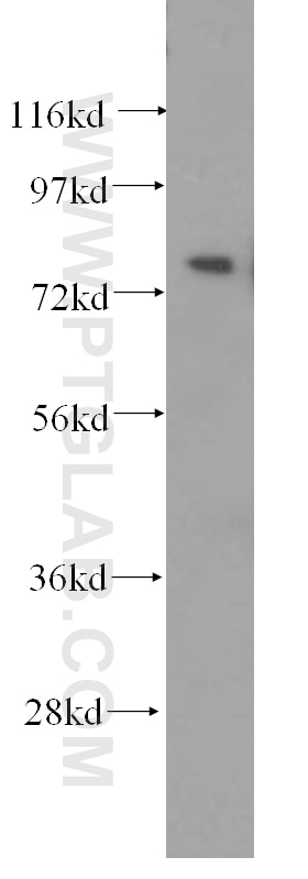 Western Blot (WB) analysis of HEK-293 cells using PHYH Polyclonal antibody (12858-1-AP)