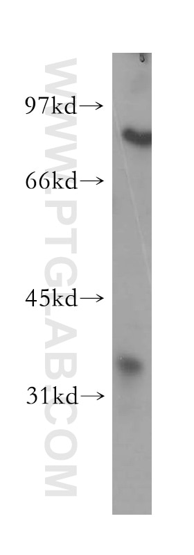 Western Blot (WB) analysis of human liver tissue using PHYH Polyclonal antibody (12858-1-AP)