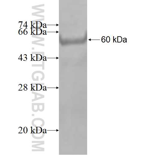 PHYH fusion protein Ag3569 SDS-PAGE