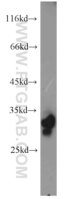 Western Blot (WB) analysis of human liver tissue using PHYHD1 Polyclonal antibody (16125-1-AP)