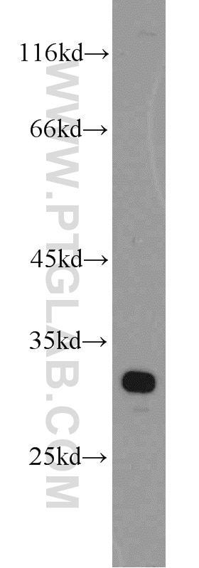 Western Blot (WB) analysis of mouse liver tissue using PHYHD1 Polyclonal antibody (16125-1-AP)
