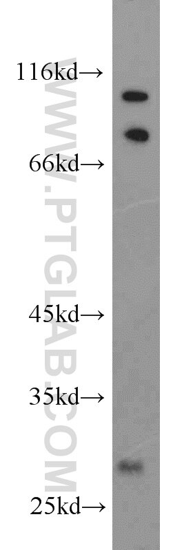 Western Blot (WB) analysis of L02 cells using PHYHD1 Polyclonal antibody (16125-1-AP)