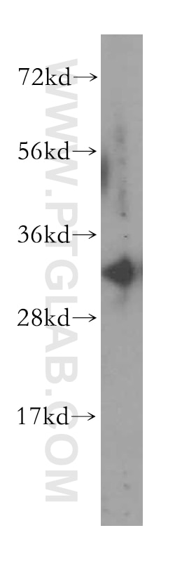 Western Blot (WB) analysis of human liver tissue using PHYHD1 Polyclonal antibody (16125-1-AP)