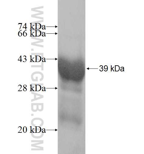 PHYHD1 fusion protein Ag9252 SDS-PAGE PHYHD1 fusion protein Ag9252 SDS-PAGE