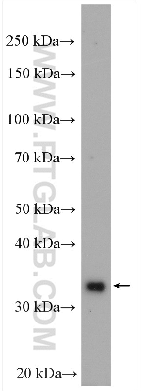 Western Blot (WB) analysis of mouse brain tissue using PHYHIP Polyclonal antibody (16984-1-AP)