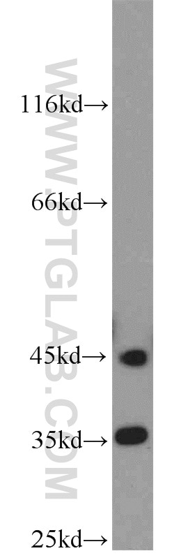 Western Blot (WB) analysis of mouse brain tissue using PHYHIP Polyclonal antibody (16984-1-AP)